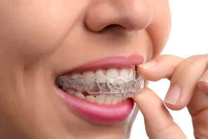 Invisalign Treatment